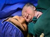 کاهش میزان ميرايى مادران به علل ناشى از باردارى در دانشگاه علوم پزشکی تبریز